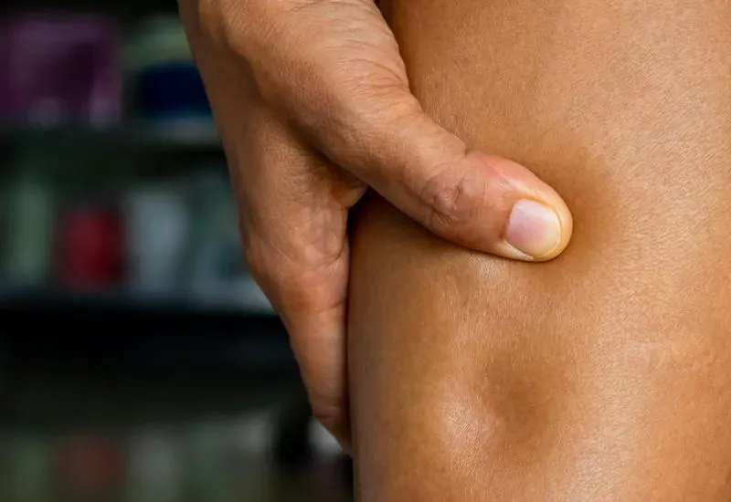 早上起床臉腫腫、眼皮浮浮的？　營養師授「留鉀排鈉」大推：12種消水腫食物
